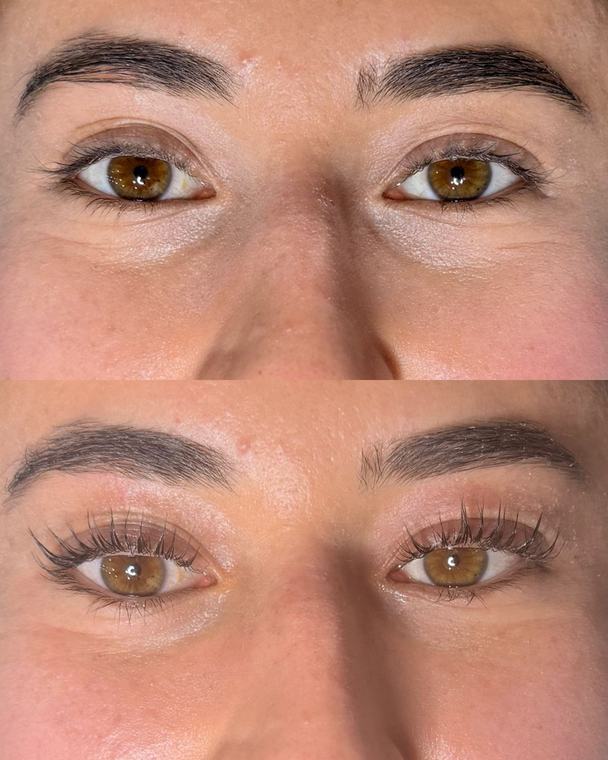 Antes e depois dos cílios