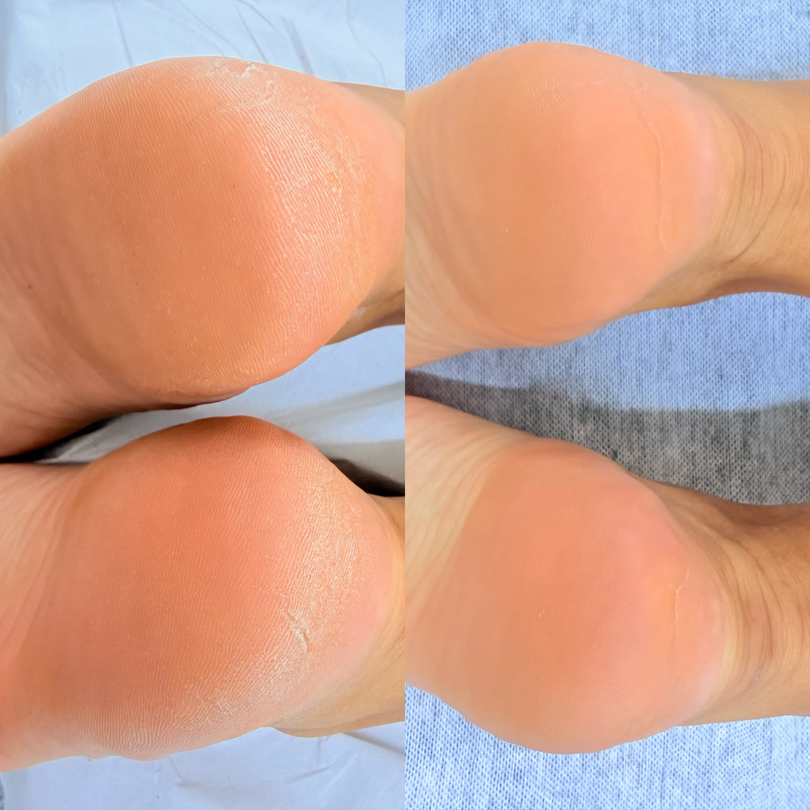 Modelo Spa dos pés